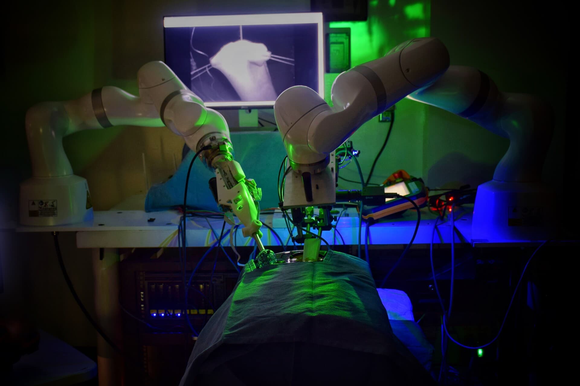 Biodegradable Balloon Spacer Surgery on 72-Year Old Marks Milestone for Minimally Invasive Orthopedics Biodegradable Balloon Spacer Surgery on 72-Year Old Marks Milestone for Minimally Invasive Orthopedics