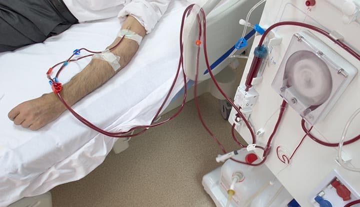 FDA Warns Hemodialysis Bloodline FDA Warns Hemodialysis Bloodline
