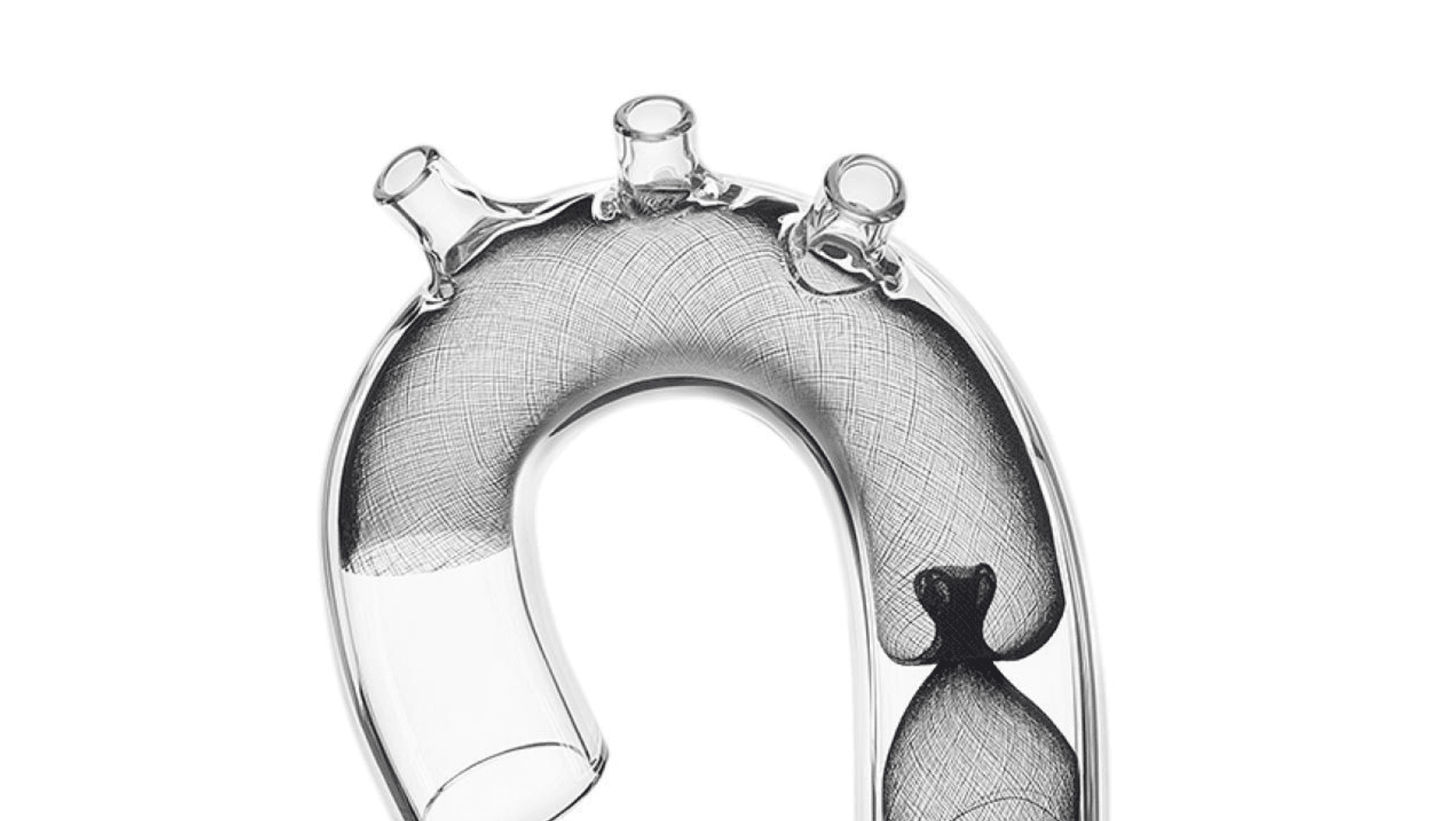 FDA Clears Emboline Emboliner for Embolic Protection During TAVR FDA Clears Emboline Emboliner for Embolic Protection During TAVR